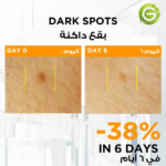 ⁦غارنييه سيروم سكين اكتيف للإشراقة السريعة مع %3 من الفيتامين سي والنياسيناميد - 12 جرعة⁩ - الصورة ⁦6⁩