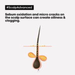 ⁦منظف عميق سكالب أدفانسد لفروة الرأس 2 في 1 مقاوم للزيوت من لوريال بروفيشنال - 250مل⁩ - الصورة ⁦2⁩