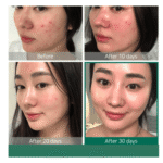 ⁦محلول تقشير مع 30% اي اتش اي و 2%بي اتش اي من ذا اورديناري - 30مل⁩ - الصورة ⁦6⁩