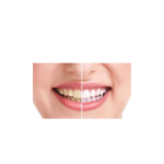 ⁦مناديل تنظيف الأسنان من ويلزياد - 12 منديل⁩ - الصورة ⁦4⁩