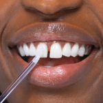 ⁦جلوستيك ملمع أسنان من هاي سمايل - 4مل⁩ - الصورة ⁦4⁩