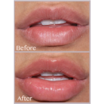 ⁦بلسم الشفاة من فليكستول - 10جرام⁩ - الصورة ⁦2⁩