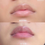 ⁦مكبر شفاه بالبطيخ من لابيلا - 8مل⁩ - الصورة ⁦2⁩